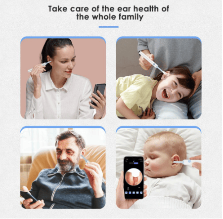 DJIWJDCDA 🔥LAST DAY-50%OFF🔥Clean Earwax-Wi-Fi Visible Wax Removal Spoon, USB 1296P HD Load Otoscope