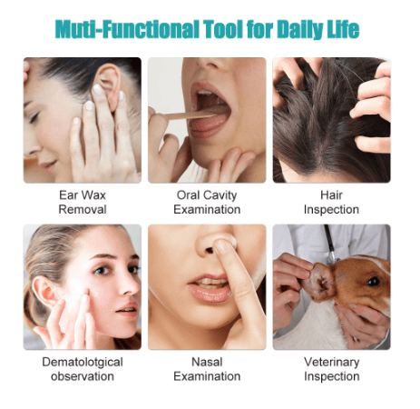 DJIWJDCDA 🔥LAST DAY-50%OFF🔥Clean Earwax-Wi-Fi Visible Wax Removal Spoon, USB 1296P HD Load Otoscope